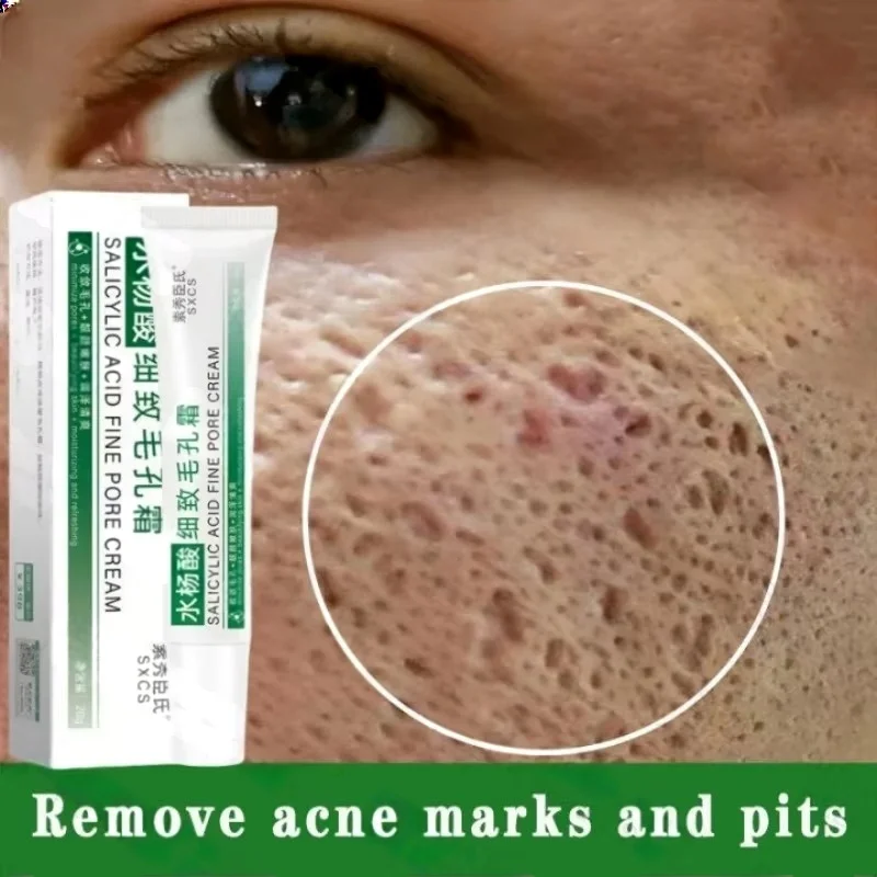 Skincare Salicylic Acid - Ácido salicílico poros limpeza creme encolher