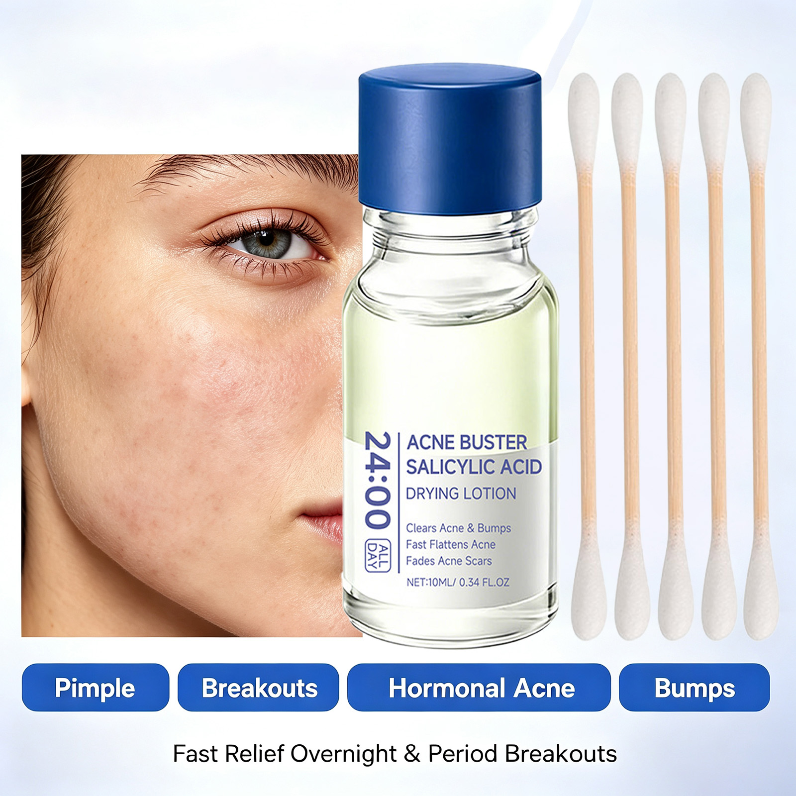 Tranexamic Acid Serum - Sérum de Tratamento para Acne com