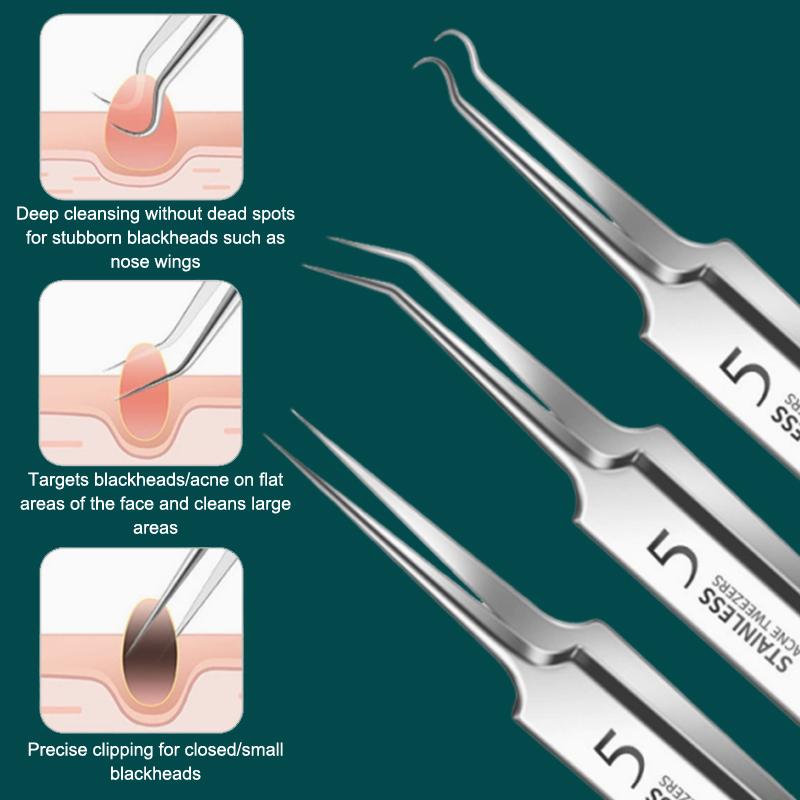 Kit Profissional de Remoção de - Skincare Acne avaliação e preço