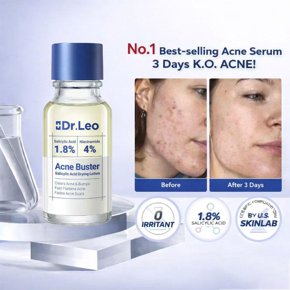 Loção de Tratamento com Ácido  - Tranexamic Acid Serum avaliação e preço