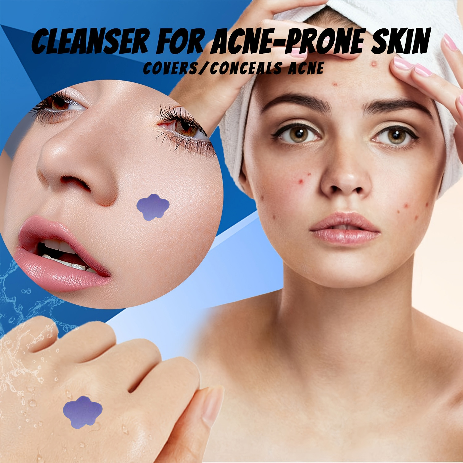 Adesivos de Microagulhas para  - Skincare Acne avaliação e preço