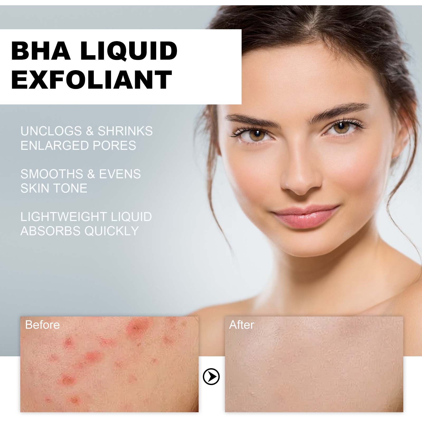 Sérum Exfoliante Líquido com 2 - Tranexamic Acid Serum avaliação e preço