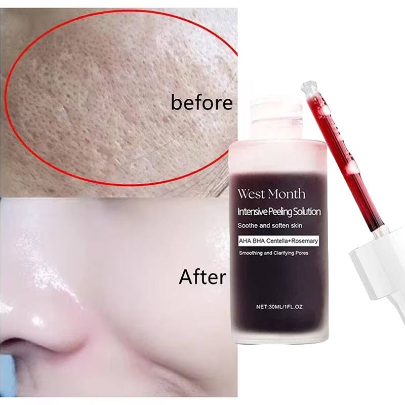 Sente-se como seda, parece um  - Tranexamic Acid Serum avaliação e preço