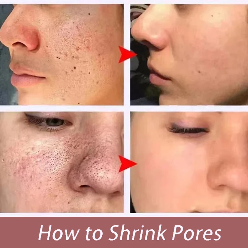 Sente-se como seda, parece um  - Tranexamic Acid Serum avaliação e preço