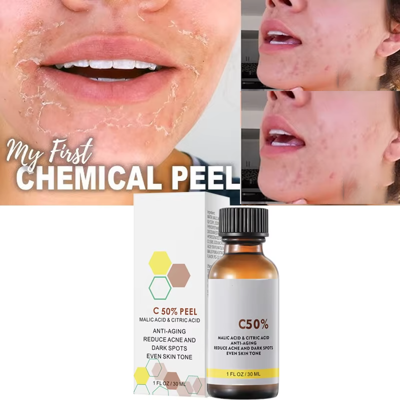 Com ácido málico e ácido cítri - Skincare Salicylic Acid avaliação e preço