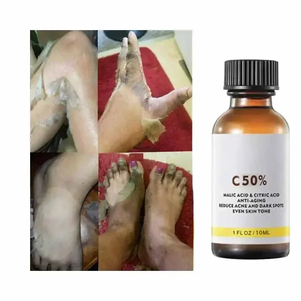 Com ácido málico e ácido cítri - Skincare Salicylic Acid avaliação e preço