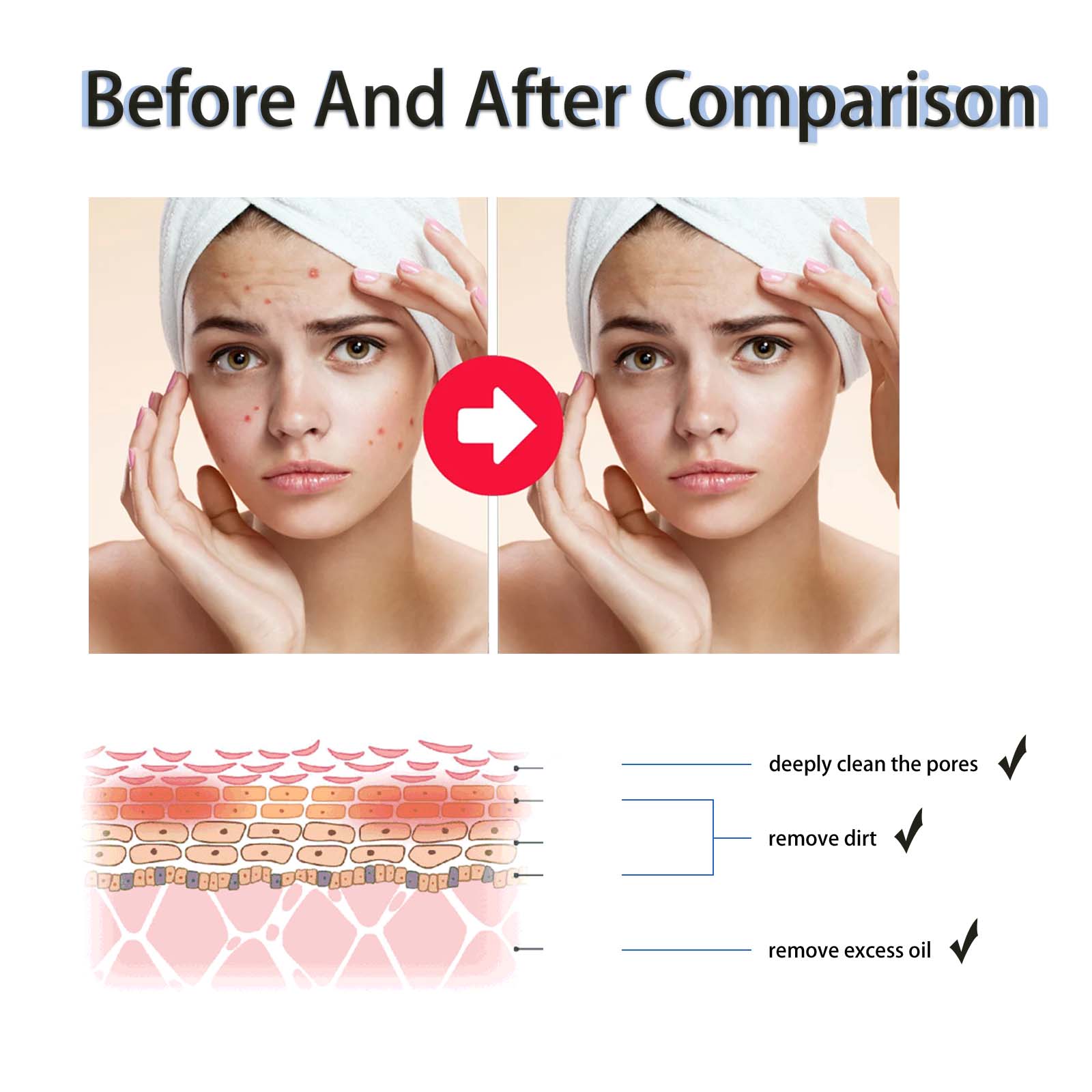 Sérum Exfoliante Líquido com 2 - Tranexamic Acid Serum avaliação e preço