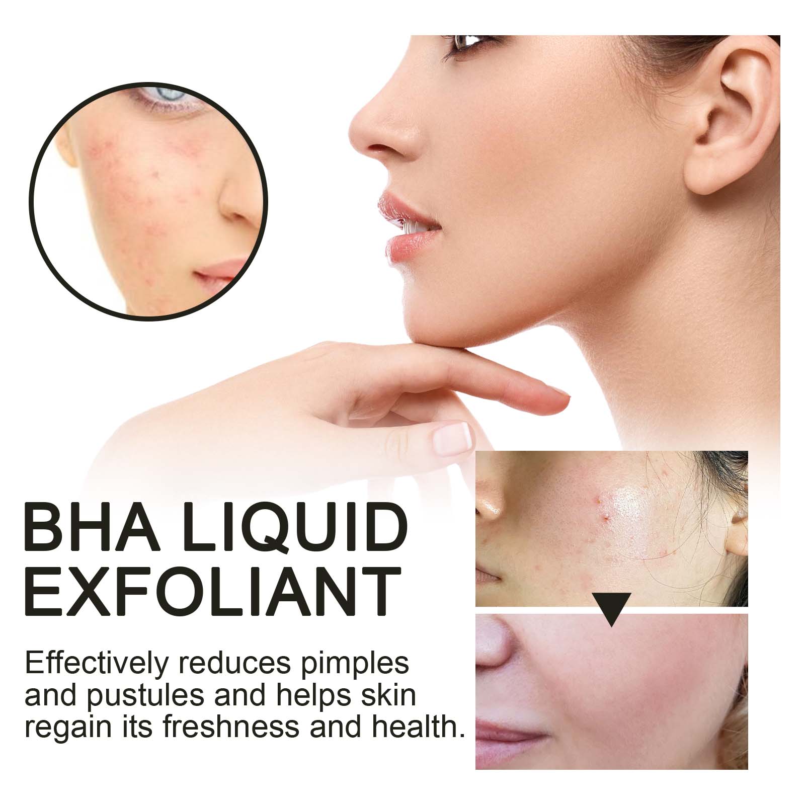 Sérum Exfoliante Líquido com 2 - Tranexamic Acid Serum avaliação e preço